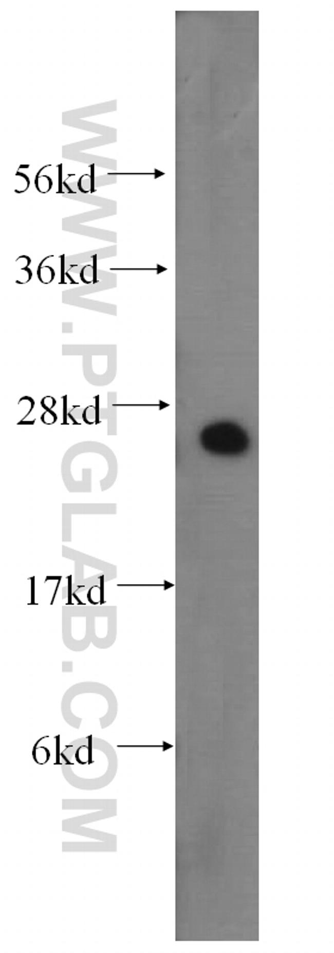 DCXR Antibody in Western Blot (WB)