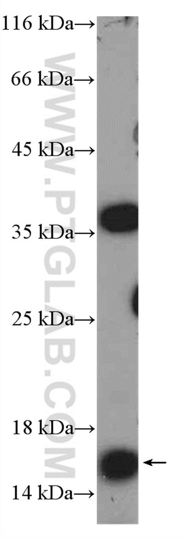 MED10 Antibody in Western Blot (WB)