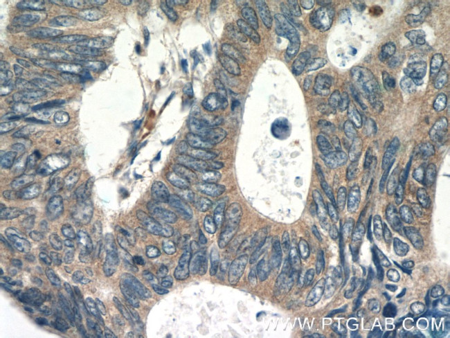 RPS3 Antibody in Immunohistochemistry (Paraffin) (IHC (P))