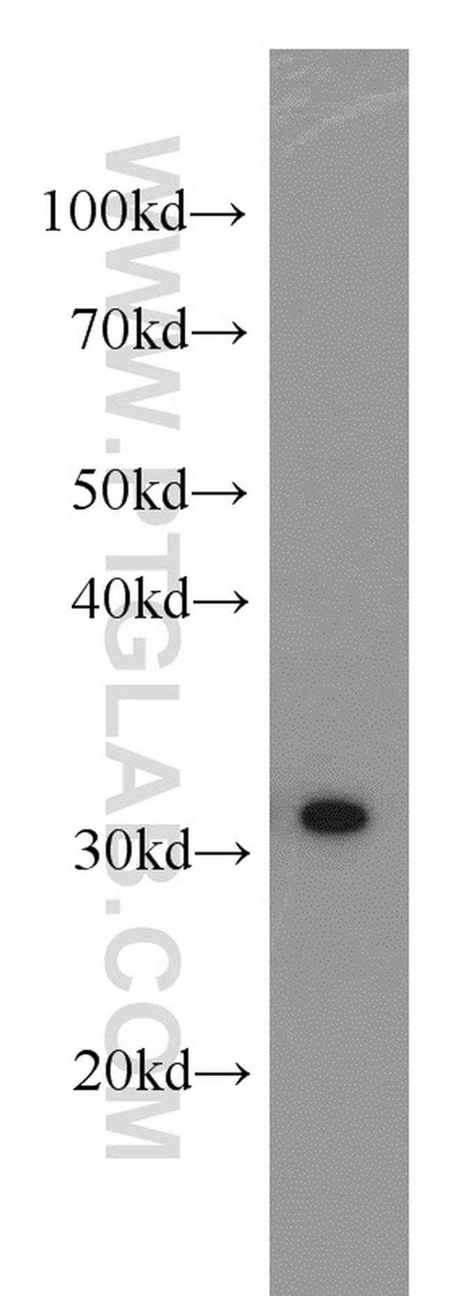 RPS3 Antibody in Western Blot (WB)