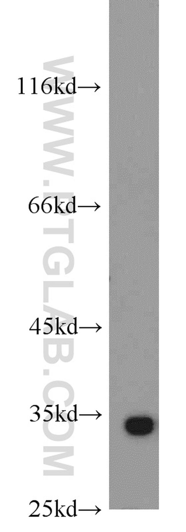 RPS3 Antibody in Western Blot (WB)