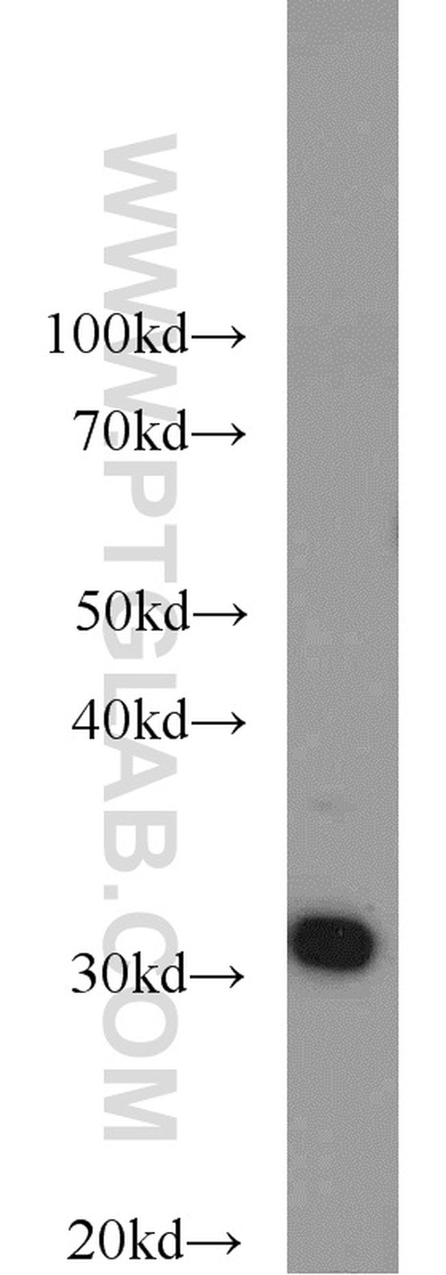 RPS3 Antibody in Western Blot (WB)