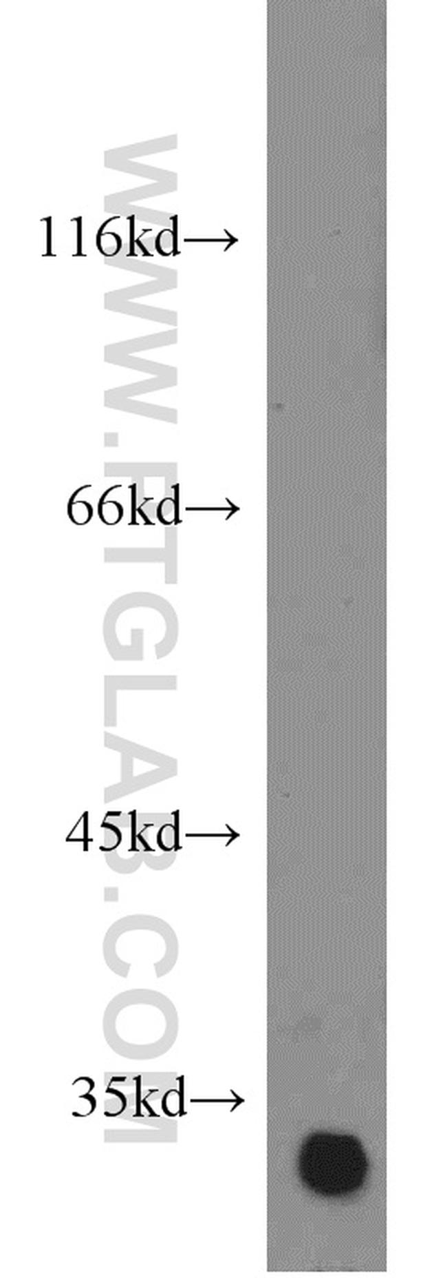 RPS3 Antibody in Western Blot (WB)