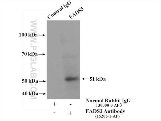 FADS3 Antibody in Immunoprecipitation (IP)