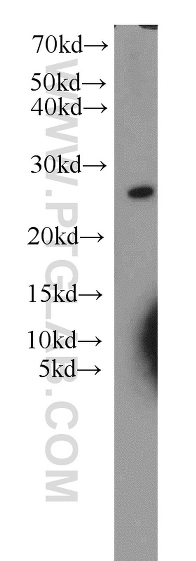 RPB5 Antibody in Western Blot (WB)