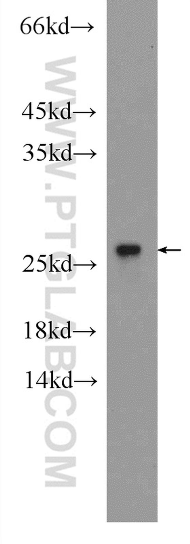 RPB5 Antibody in Western Blot (WB)