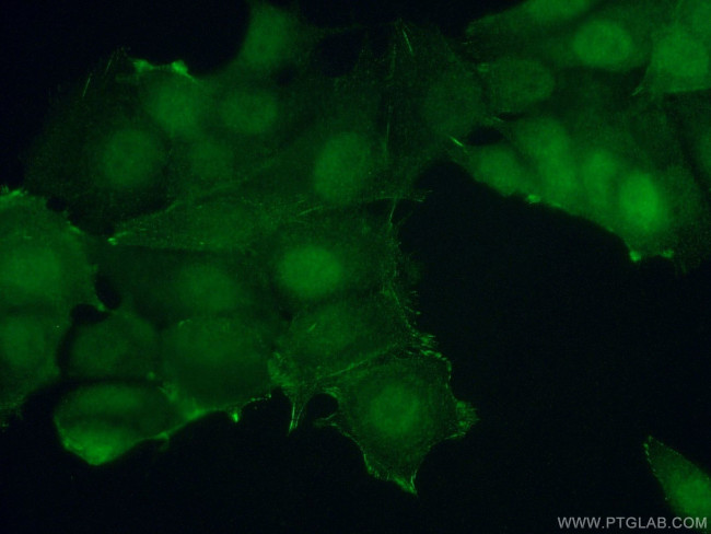 S6K2 Antibody in Immunocytochemistry (ICC/IF)