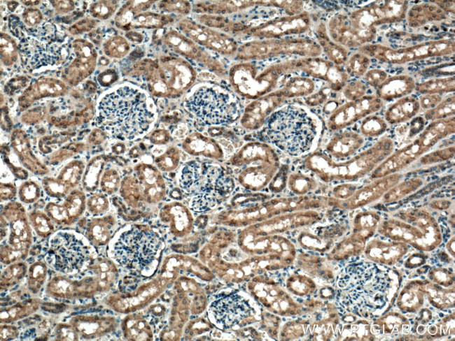 S6K2 Antibody in Immunohistochemistry (Paraffin) (IHC (P))