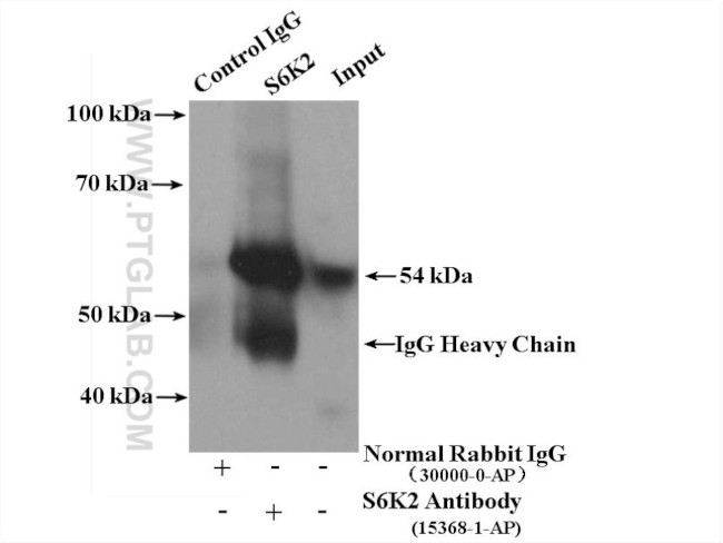 S6K2 Antibody in Immunoprecipitation (IP)