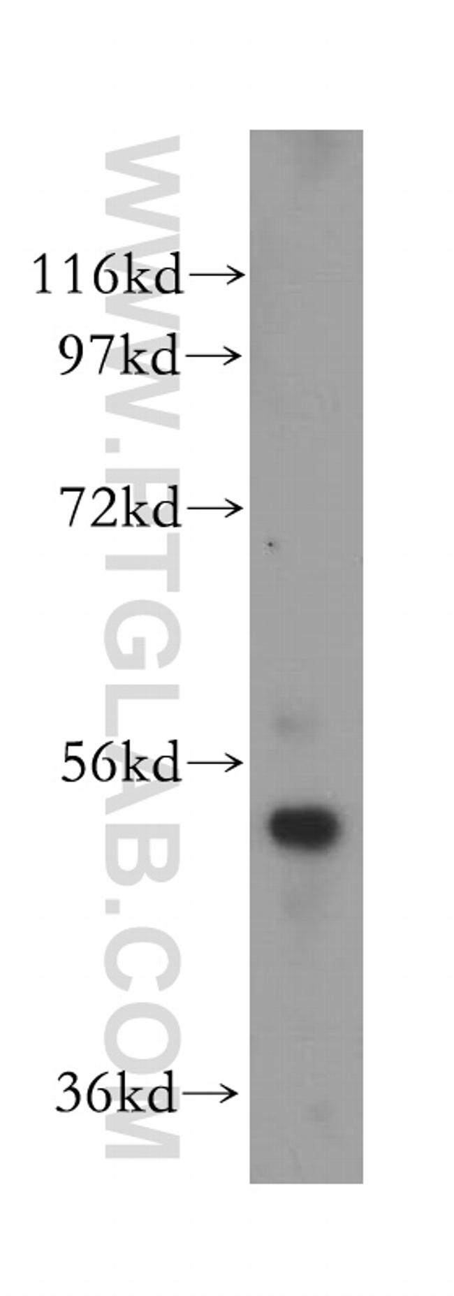 S6K2 Antibody in Western Blot (WB)