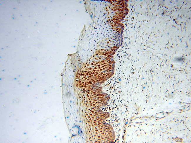 DHRS4 Antibody in Immunohistochemistry (Paraffin) (IHC (P))