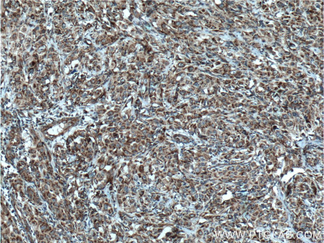 DHRS4 Antibody in Immunohistochemistry (Paraffin) (IHC (P))