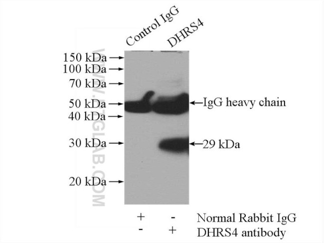 DHRS4 Antibody in Immunoprecipitation (IP)