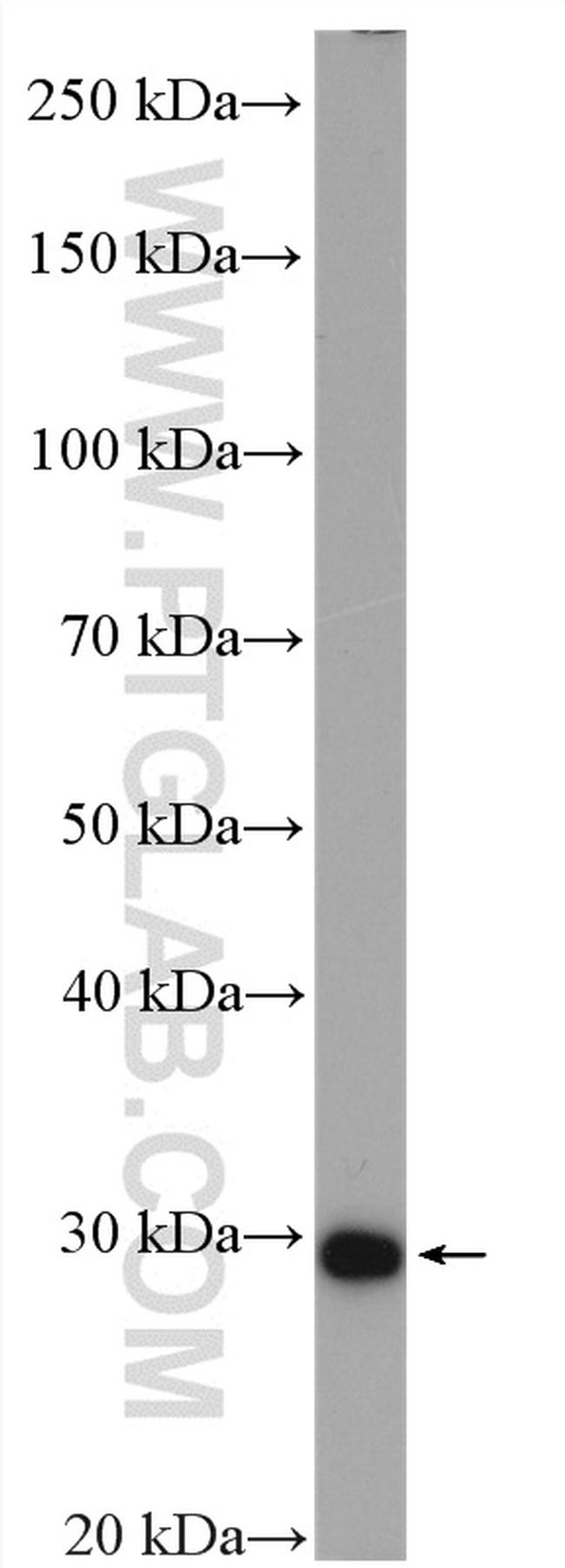 DHRS4 Antibody in Western Blot (WB)