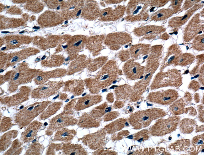 TXNL1 Antibody in Immunohistochemistry (Paraffin) (IHC (P))