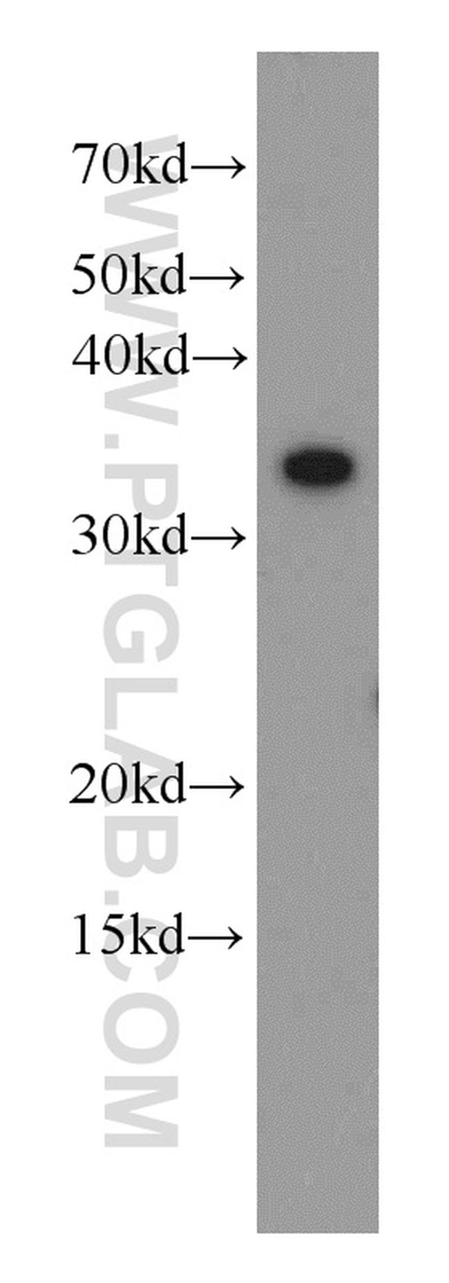 TXNL1 Antibody in Western Blot (WB)