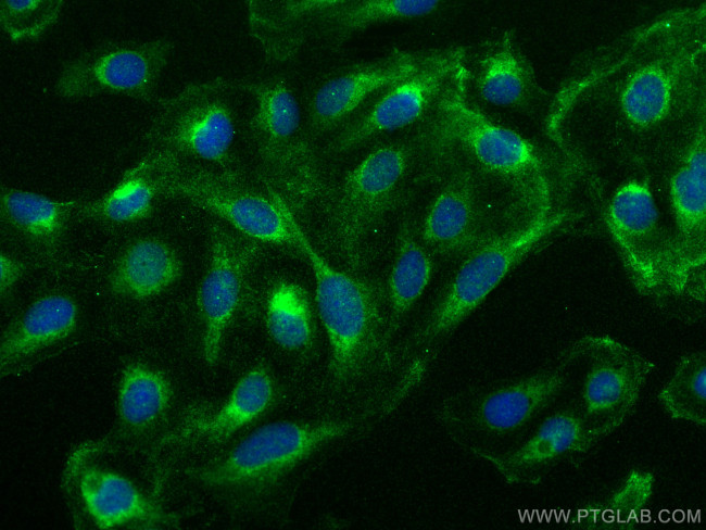 MCOLN1 Antibody in Immunocytochemistry (ICC/IF)