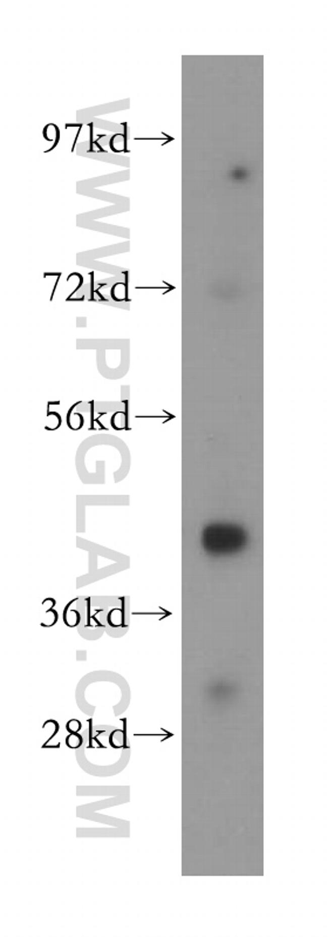 MAGEA10 Antibody in Western Blot (WB)