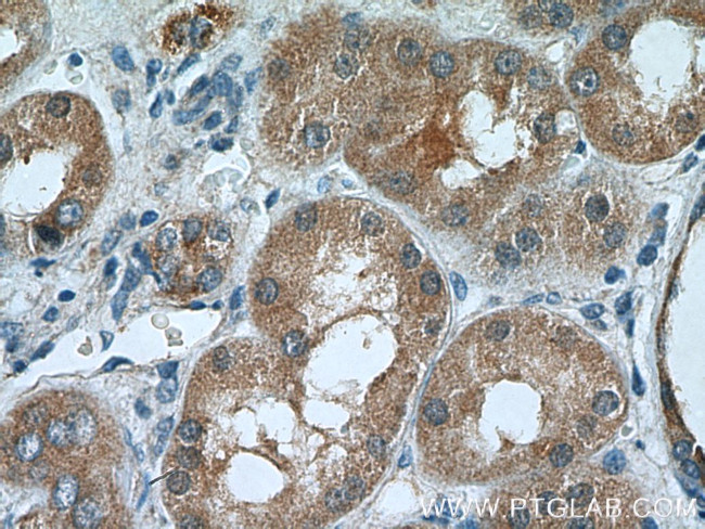 TSTA3 Antibody in Immunohistochemistry (Paraffin) (IHC (P))