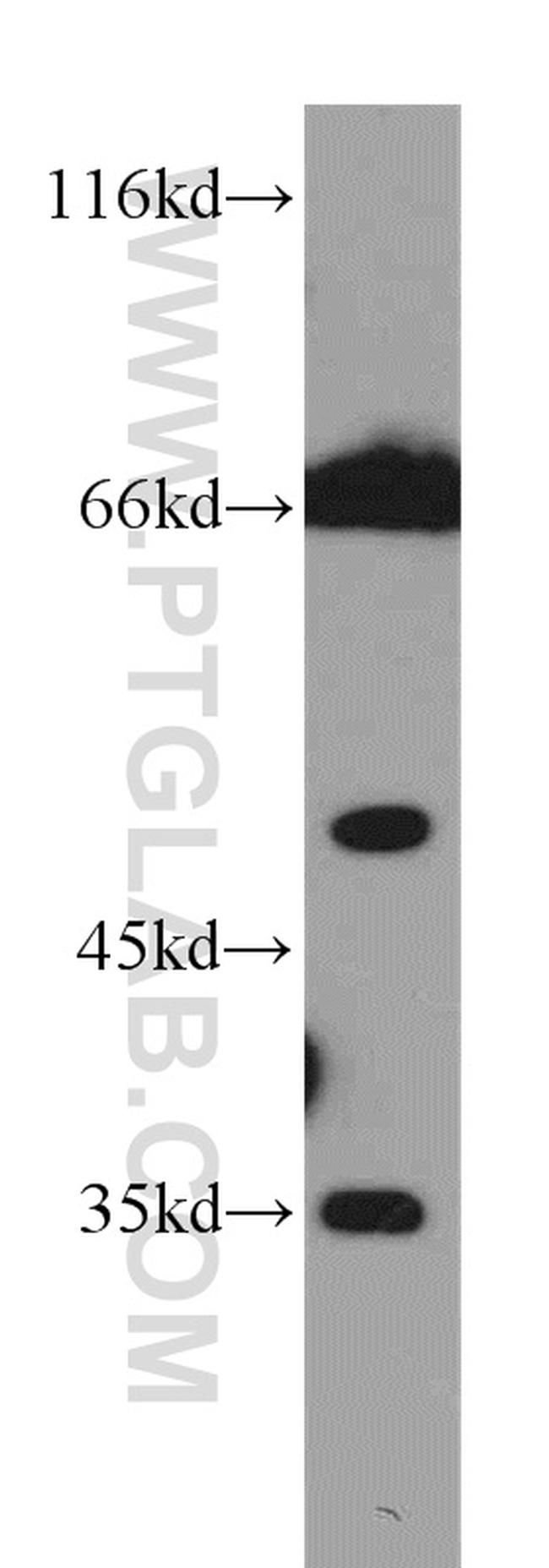 CHST12 Antibody in Western Blot (WB)