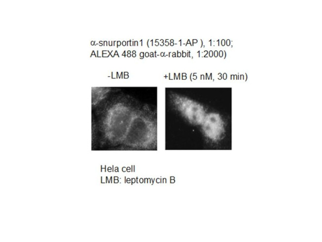 SNUPN Antibody in Immunocytochemistry (ICC/IF)