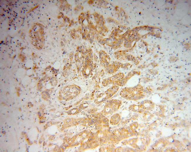 DTYMK Antibody in Immunohistochemistry (Paraffin) (IHC (P))