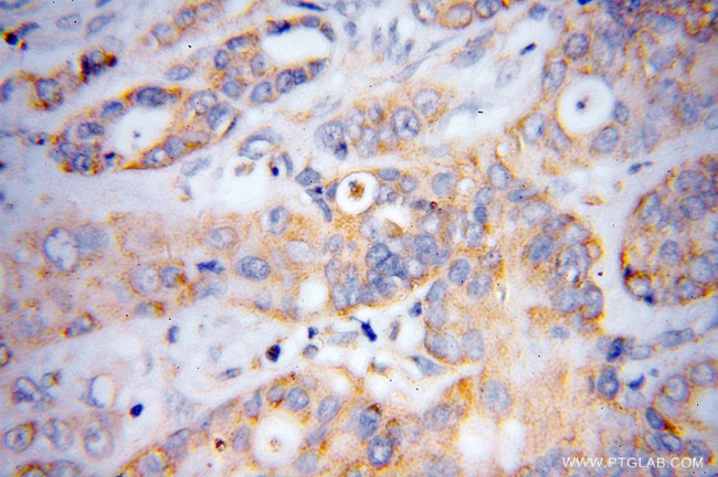 DTYMK Antibody in Immunohistochemistry (Paraffin) (IHC (P))