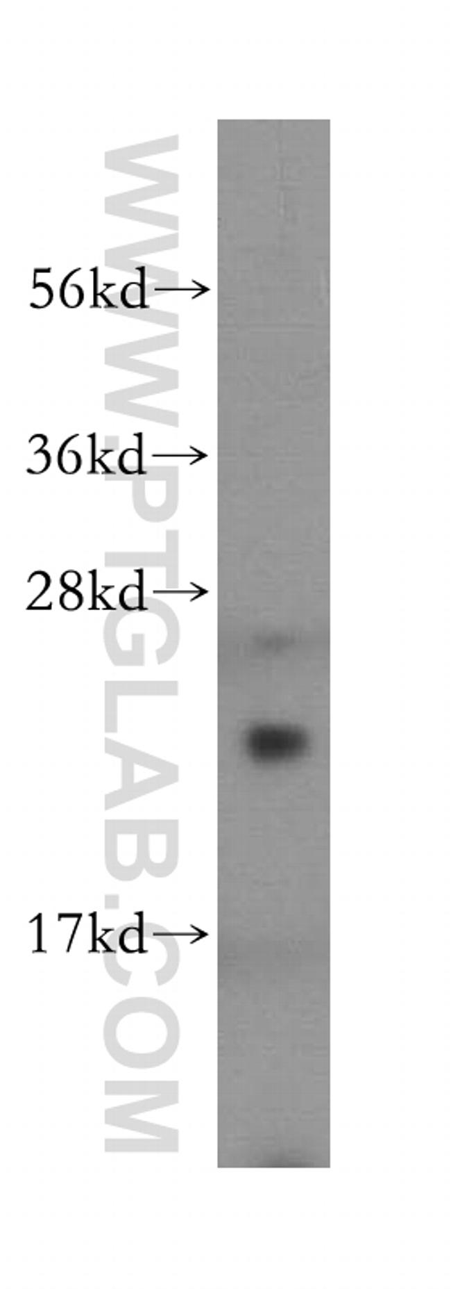 DTYMK Antibody in Western Blot (WB)