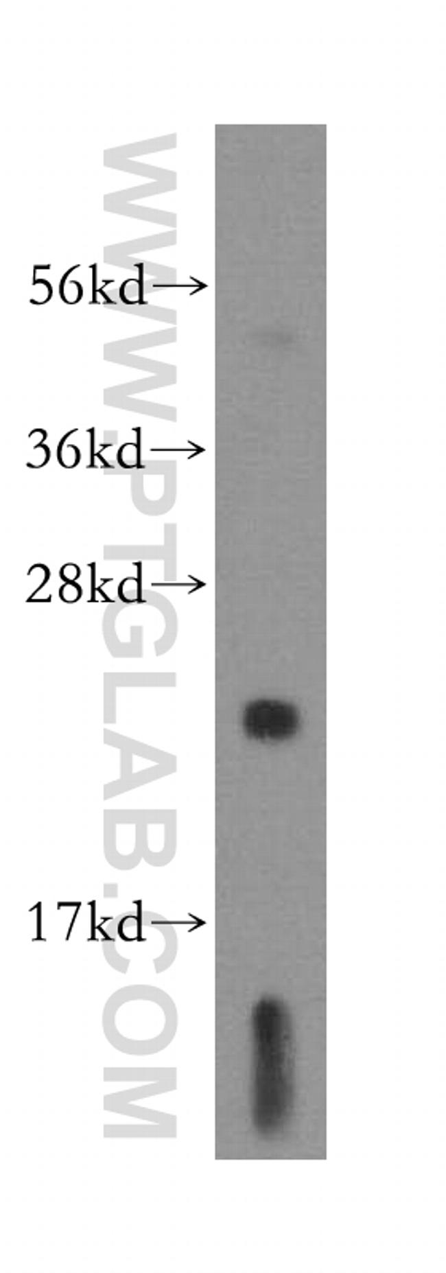 DTYMK Antibody in Western Blot (WB)