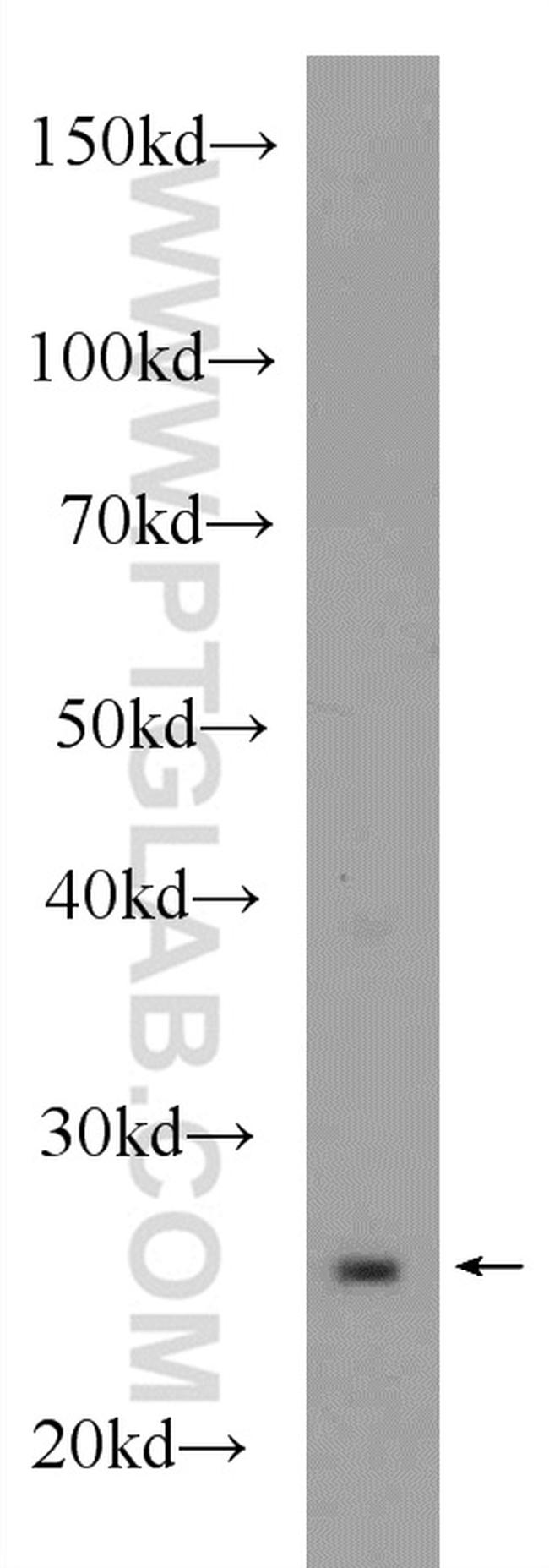 DTYMK Antibody in Western Blot (WB)