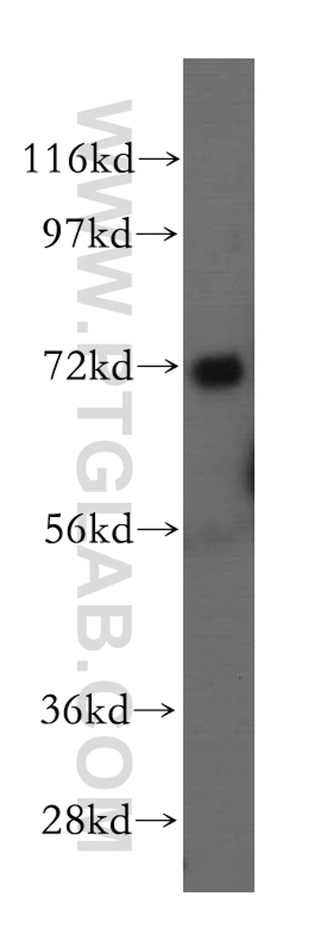 BRCC3 Antibody in Western Blot (WB)