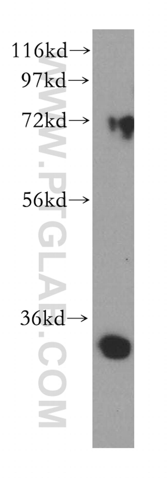 DHRS3 Antibody in Western Blot (WB)