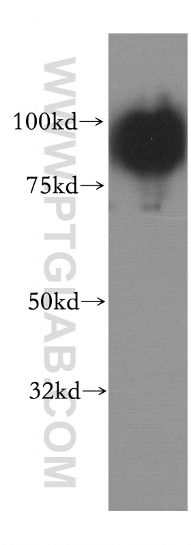 SATB1 Antibody in Western Blot (WB)