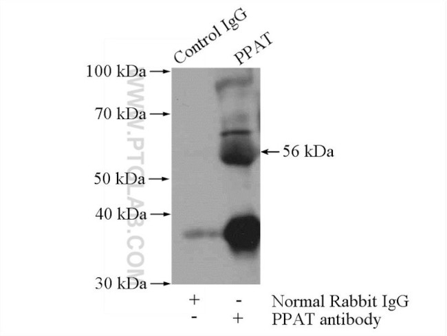 PPAT Antibody in Immunoprecipitation (IP)