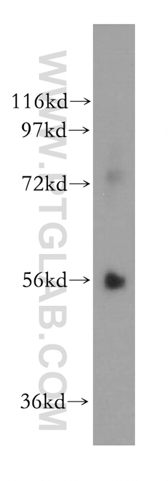 PPAT Antibody in Western Blot (WB)