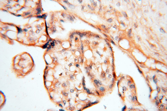 CA11 Antibody in Immunohistochemistry (Paraffin) (IHC (P))