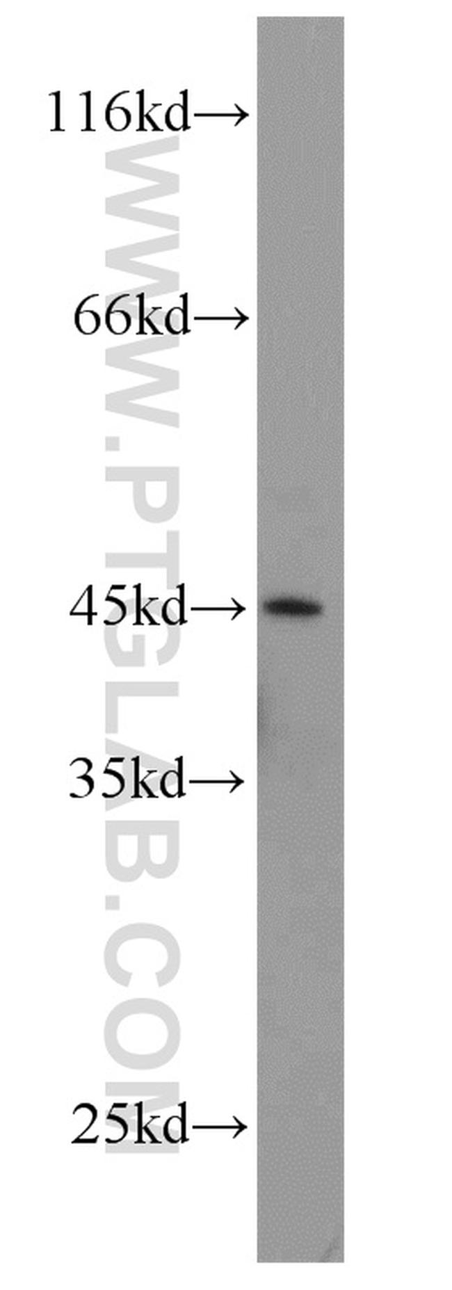 CA11 Antibody in Western Blot (WB)
