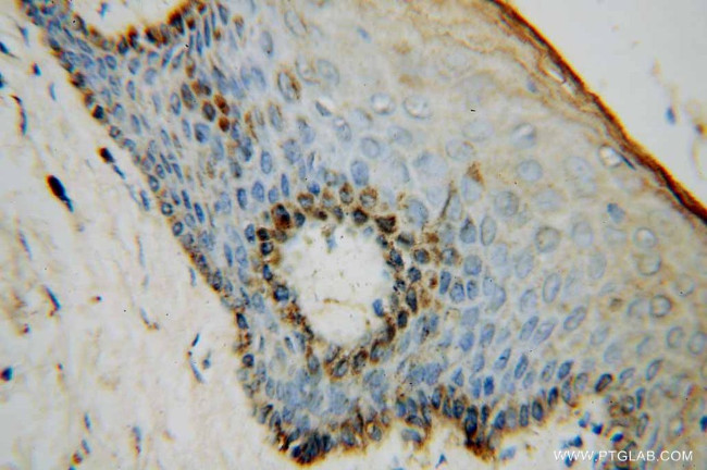 NSUN5 Antibody in Immunohistochemistry (Paraffin) (IHC (P))