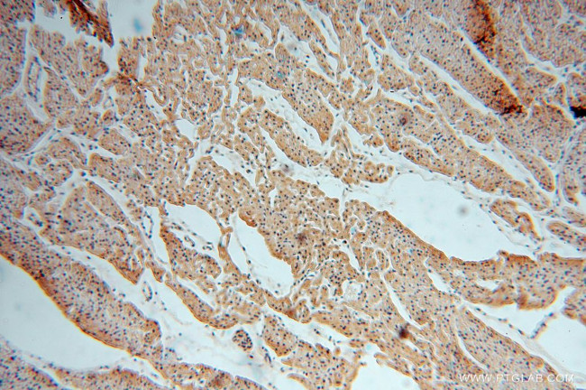 MYLIP Antibody in Immunohistochemistry (Paraffin) (IHC (P))