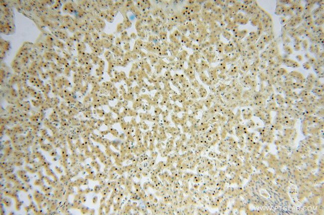 MYLIP Antibody in Immunohistochemistry (Paraffin) (IHC (P))