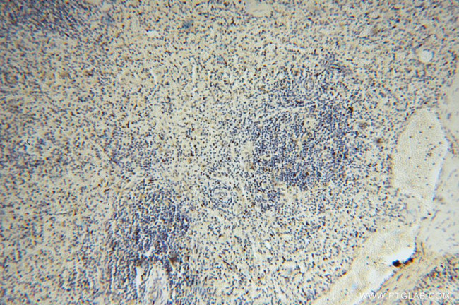 MYLIP Antibody in Immunohistochemistry (Paraffin) (IHC (P))