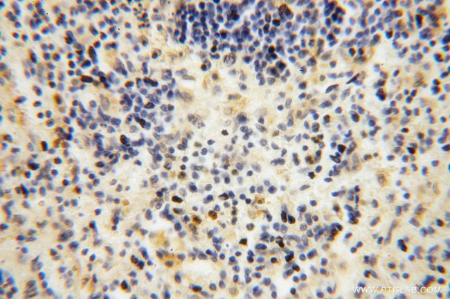 MYLIP Antibody in Immunohistochemistry (Paraffin) (IHC (P))