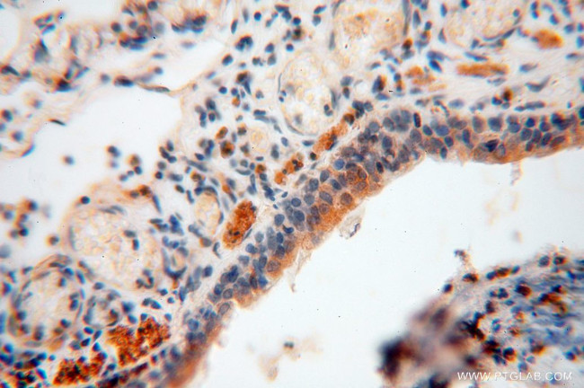 MYLIP Antibody in Immunohistochemistry (Paraffin) (IHC (P))