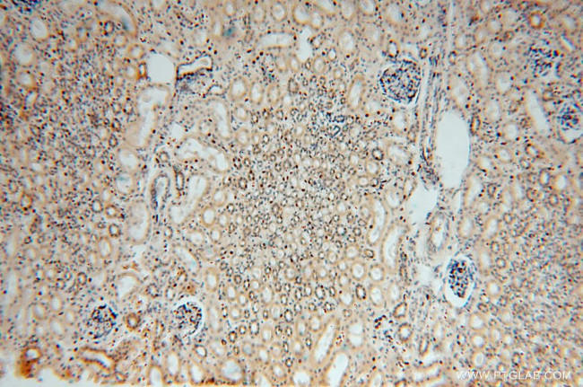 MYLIP Antibody in Immunohistochemistry (Paraffin) (IHC (P))