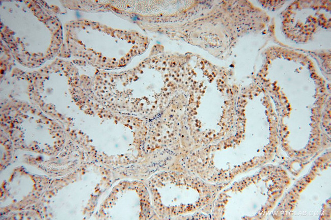 MYLIP Antibody in Immunohistochemistry (Paraffin) (IHC (P))