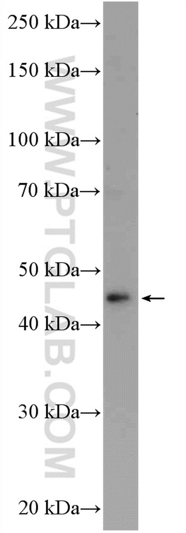 MYLIP Antibody in Western Blot (WB)