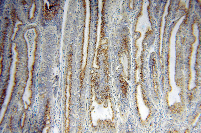 YIPF4 Antibody in Immunohistochemistry (Paraffin) (IHC (P))