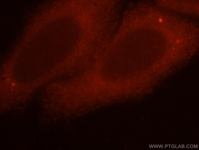 UNC45A Antibody in Immunocytochemistry (ICC/IF)