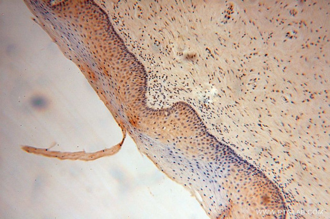 UNC45A Antibody in Immunohistochemistry (Paraffin) (IHC (P))