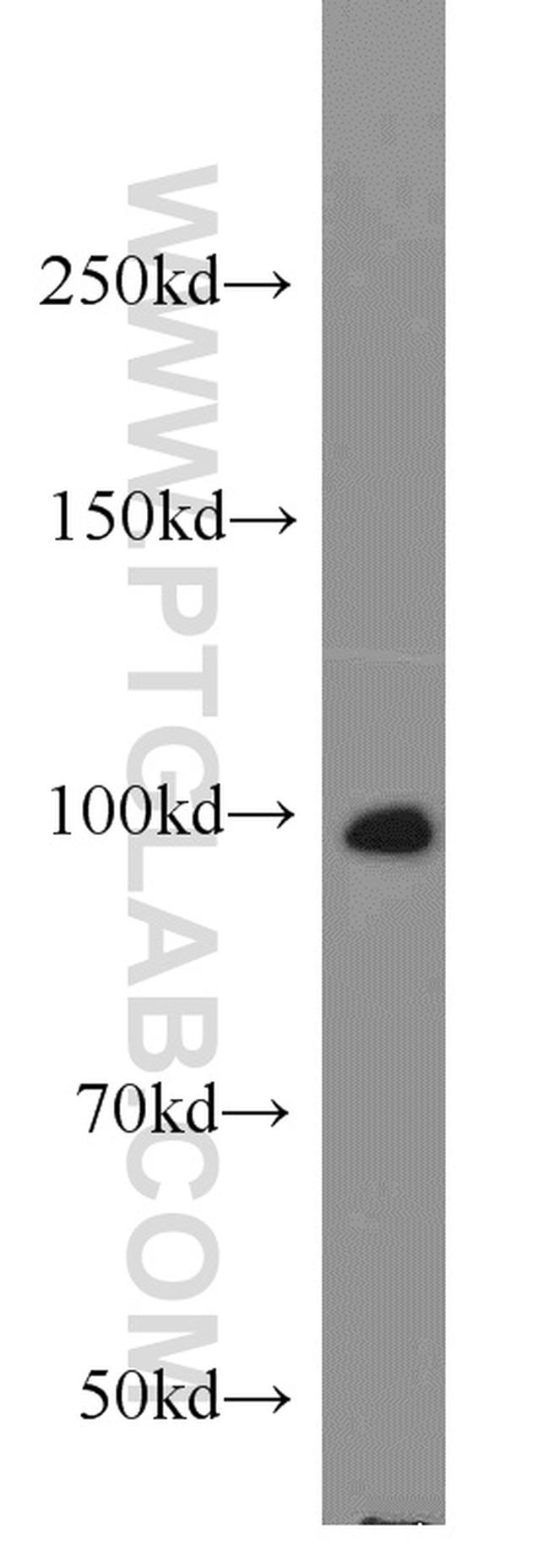 UNC45A Antibody in Western Blot (WB)